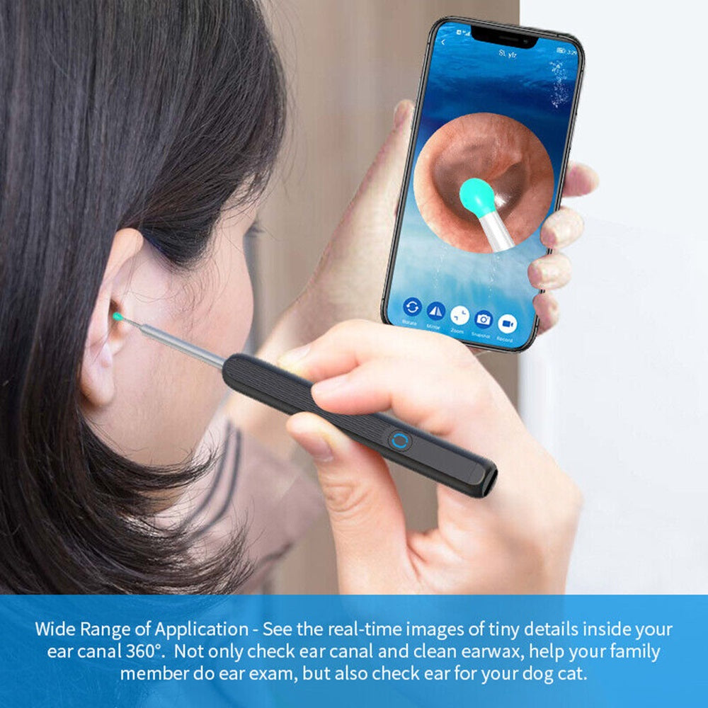 Wireless Ear Wax Remover