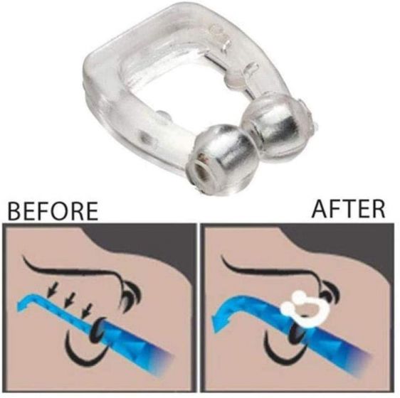 Anti-Snore Nose Clip