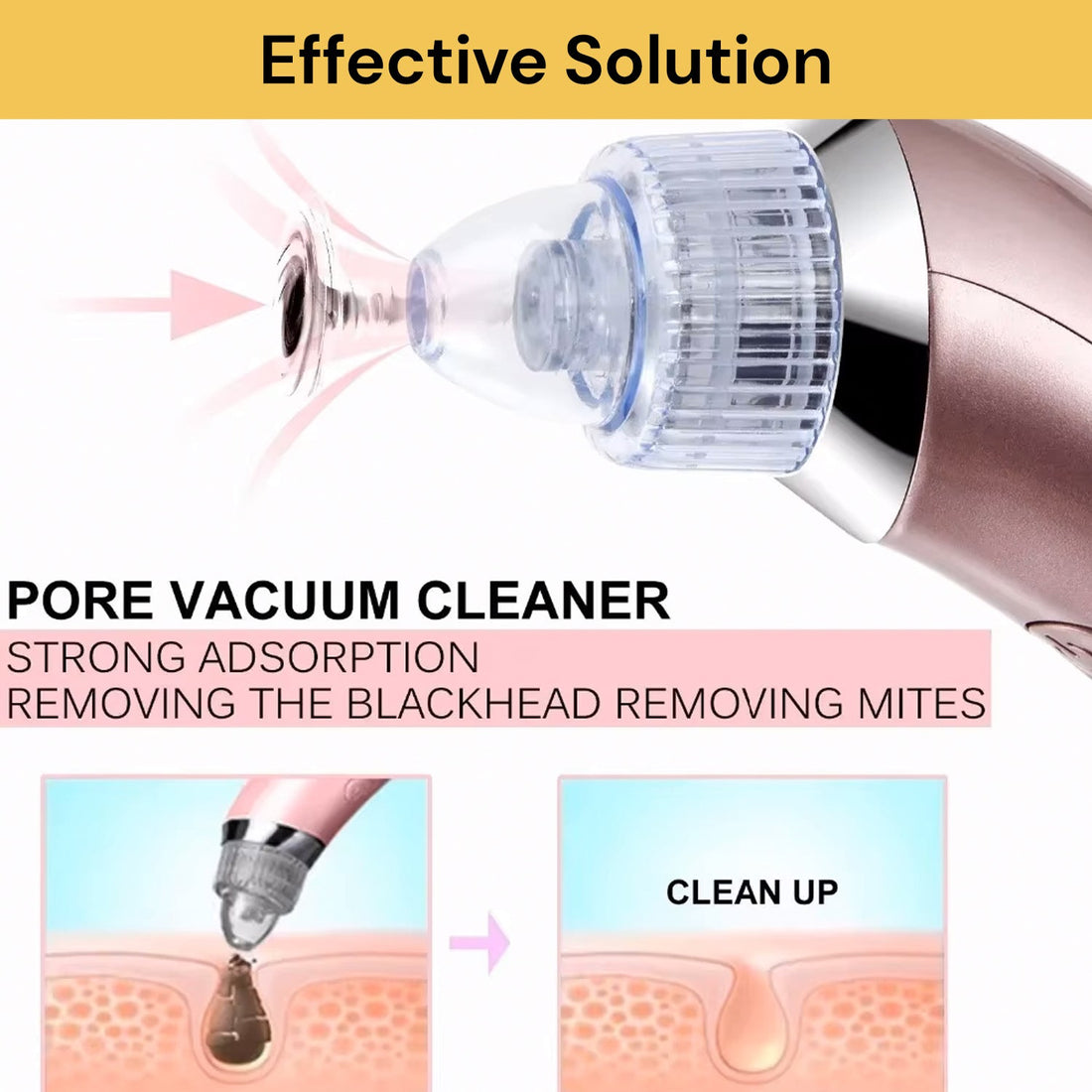 Electric Blackhead Suction Remover