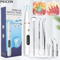 Ultrasonic Dental Stain and Plaque Remover Prily